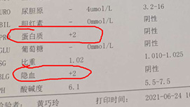 紫癜性肾炎