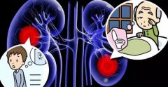 过敏性紫癜100%引起肾损伤？得了过敏性紫癜应重视定期尿检！