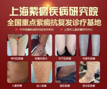 过敏性紫癜抗复发诊疗的优势有哪些？